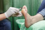 Common Foot Skin Problems Treatments Foot And Ankle Group