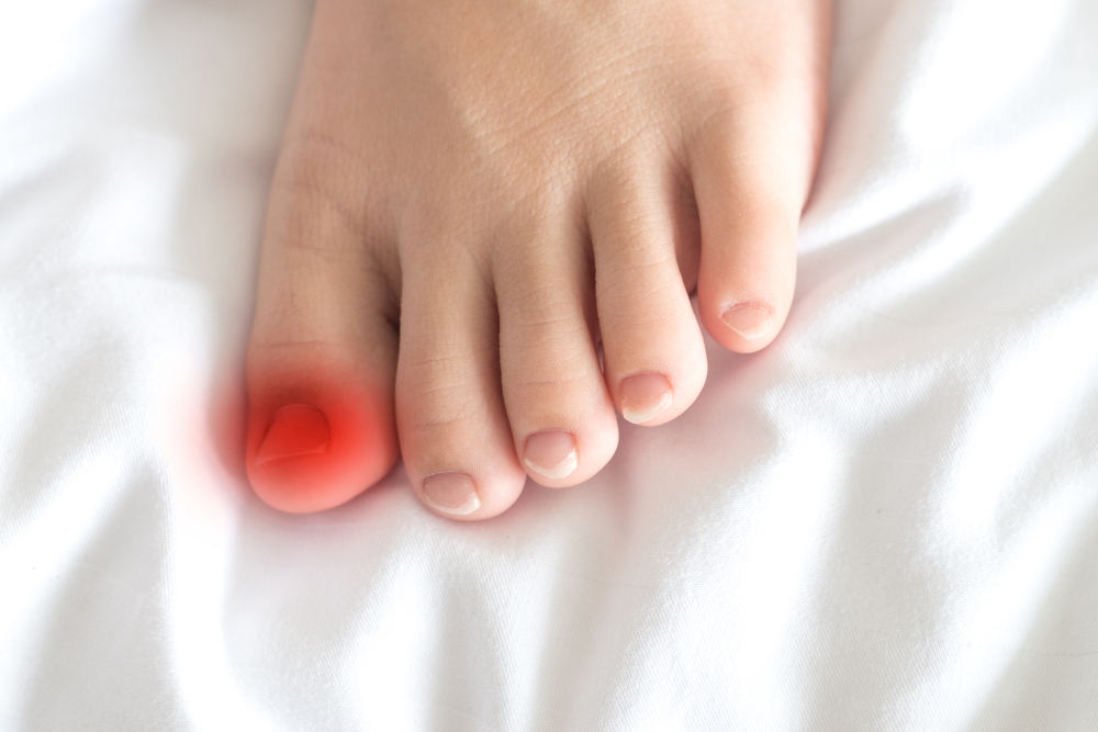 signs-your-ingrown-toenail-is-infected-southwest-florida-podiatrist