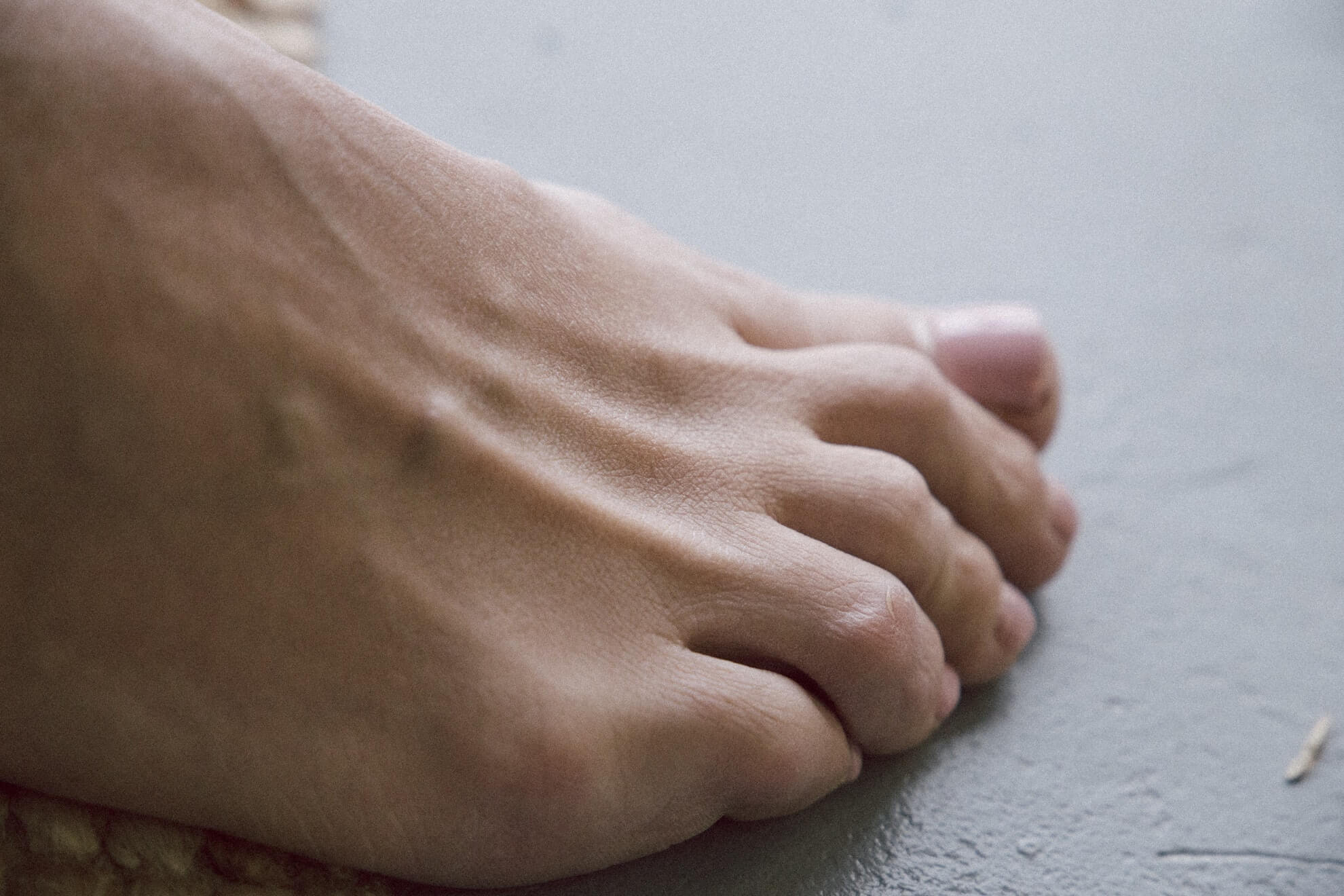 7 Signs Of Arthritis In Your Feet Foot And Ankle Group